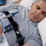 Understanding Sleep Apnea: A Comprehensive Overview