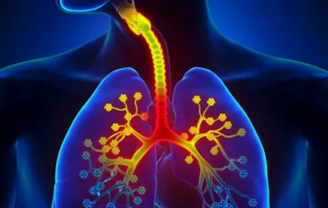 bronchitis from smoking cigarettes Acute Profound Does Smoking Cause Bronchitis?