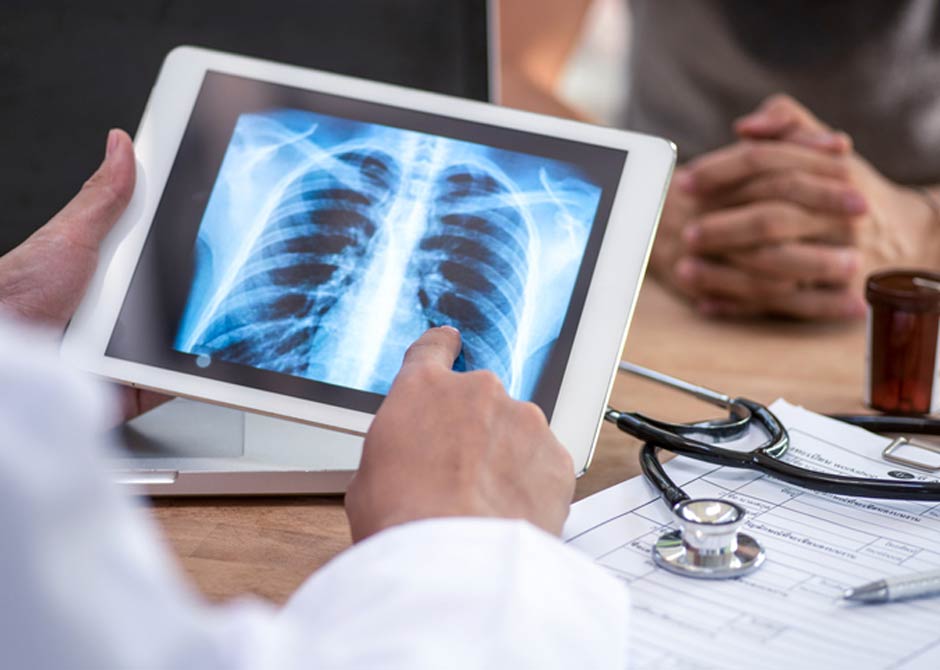 Doctor reviewing a lung X-ray on a digital tablet for signs of lung disease