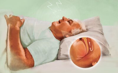 Person struggling to sleep due to summer heat and sleep apnea breathing issues